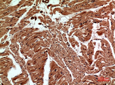 Fig.2. Immunohistochemical analysis of paraffin-embedded human-heart, antibody was diluted at 1:100.