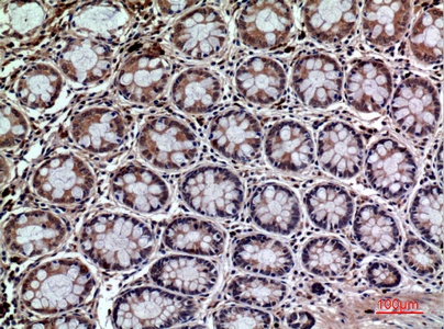 Fig.4. Immunohistochemical analysis of paraffin-embedded human-colon, antibody was diluted at 1:100.