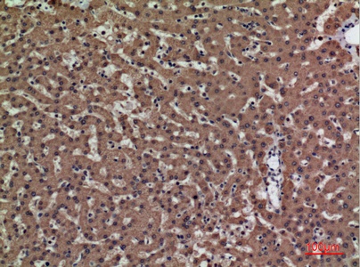 Fig.2. Immunohistochemical analysis of paraffin-embedded human-liver, antibody was diluted at 1:100.