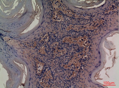 Fig.2. Immunohistochemical analysis of paraffin-embedded human-skin, antibody was diluted at 1:100.