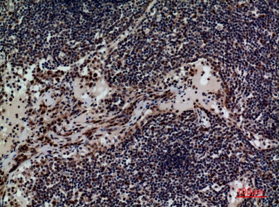 Fig.2. Immunohistochemical analysis of paraffin-embedded human-lymph, antibody was diluted at 1:100.