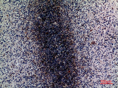 Fig.4. Immunohistochemical analysis of paraffin-embedded human-spleen, antibody was diluted at 1:100.