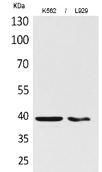 Fig.1. Western Blot analysis of K562,  L929 cells using CD84 Polyclonal Antibody. Secondary antibody (catalog#: A21020) was diluted at 1:20000.