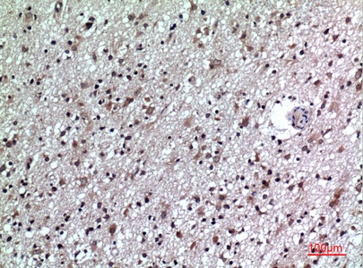 Fig.2. Immunohistochemical analysis of paraffin-embedded human-brain, antibody was diluted at 1:100.