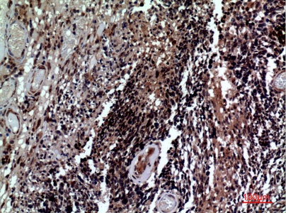 Fig.3. Immunohistochemical analysis of paraffin-embedded human-brain, antibody was diluted at 1:100.