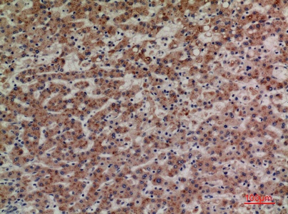 Fig.2. Immunohistochemical analysis of paraffin-embedded human-liver, antibody was diluted at 1:100.
