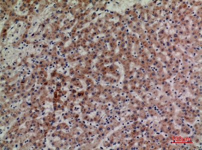 Fig.3. Immunohistochemical analysis of paraffin-embedded human-liver, antibody was diluted at 1:100.
