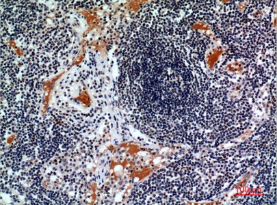 Fig.2. Immunohistochemical analysis of paraffin-embedded human-lymph, antibody was diluted at 1:100.