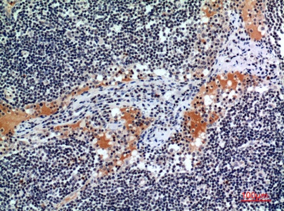 Fig.3. Immunohistochemical analysis of paraffin-embedded human-lymph, antibody was diluted at 1:100.
