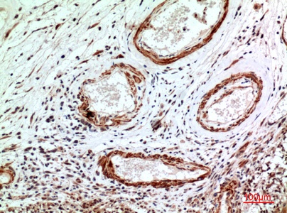 Fig.2. Immunohistochemical analysis of paraffin-embedded human-brain, antibody was diluted at 1:100.