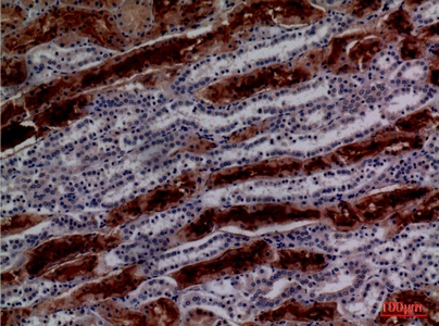 Fig.3. Immunohistochemical analysis of paraffin-embedded human-kidney, antibody was diluted at 1:100.