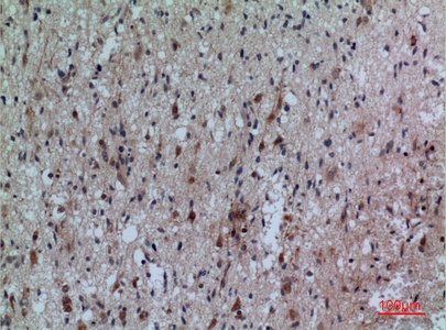 Fig.3. Immunohistochemical analysis of paraffin-embedded human-brain, antibody was diluted at 1:100.