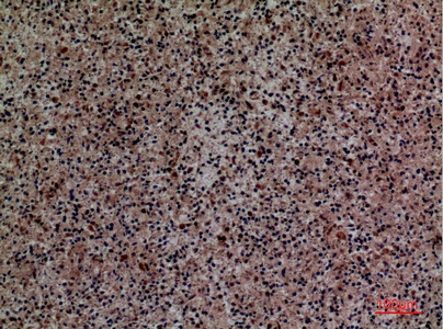 Fig.2. Immunohistochemical analysis of paraffin-embedded human-spleen, antibody was diluted at 1:100.