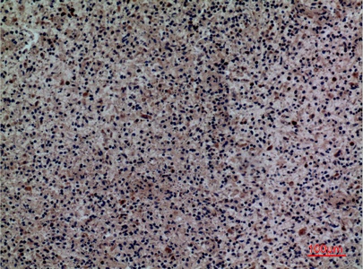 Fig.3. Immunohistochemical analysis of paraffin-embedded human-spleen, antibody was diluted at 1:100.