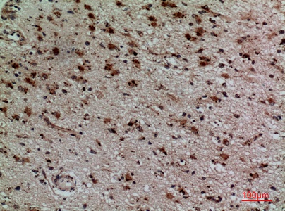 Fig.5. Immunohistochemical analysis of paraffin-embedded human-brain, antibody was diluted at 1:100.
