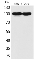 Fig.1. Western Blot analysis of K562,  MCF7 cells using CD203c Polyclonal Antibody. Antibody was diluted at 1:2000. Secondary antibody (catalog#: A21020) was diluted at 1:20000.