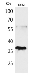 Fig. Western Blot analysis of K562 cells using CD207 Polyclonal Antibody. Secondary antibody (catalog#: A21020) was diluted at 1:20000.