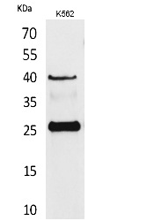 Fig. Western Blot analysis of K562 cells using CD161 Polyclonal Antibody. Secondary antibody (catalog#: A21020) was diluted at 1:20000.