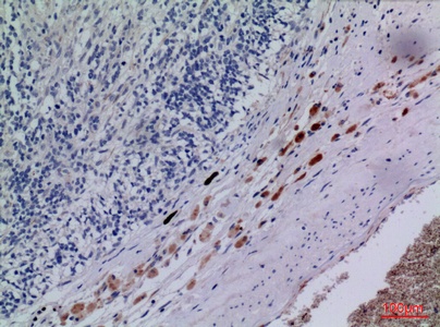 Fig.2. Immunohistochemical analysis of paraffin-embedded human-brain, antibody was diluted at 1:100.