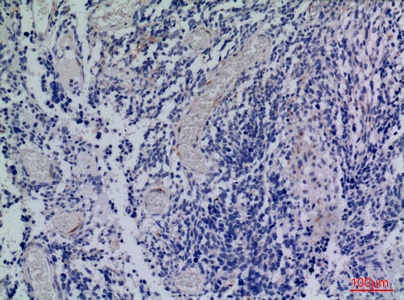 Fig.3. Immunohistochemical analysis of paraffin-embedded human-brain, antibody was diluted at 1:100.