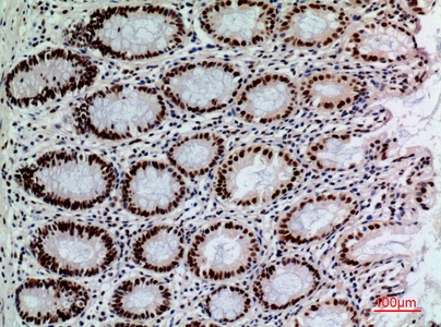 Fig.2. Immunohistochemical analysis of paraffin-embedded human-colon, antibody was diluted at 1:100.