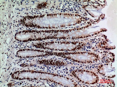 Fig.4. Immunohistochemical analysis of paraffin-embedded human-colon, antibody was diluted at 1:100.
