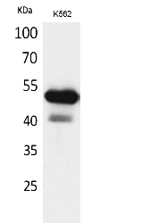 Fig.1. Western Blot analysis of K562 cells using CD328 Polyclonal Antibody. Secondary antibody (catalog#: A21020) was diluted at 1:20000.