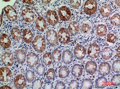 Fig.2. Immunohistochemical analysis of paraffin-embedded human-colon, antibody was diluted at 1:100.
