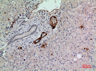 Fig.2. Immunohistochemical analysis of paraffin-embedded human-liver, antibody was diluted at 1:100.