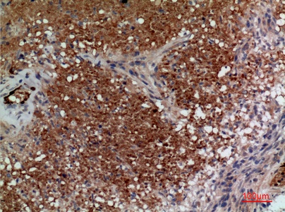 Fig.4. Immunohistochemical analysis of paraffin-embedded human-brain, antibody was diluted at 1:100.