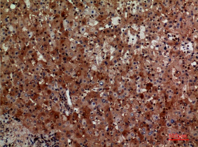Fig.2. Immunohistochemical analysis of paraffin-embedded human-liver, antibody was diluted at 1:100.