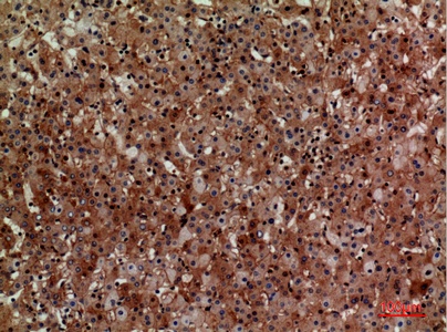 Fig.3. Immunohistochemical analysis of paraffin-embedded human-liver, antibody was diluted at 1:100.