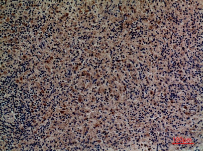 Fig.3. Immunohistochemical analysis of paraffin-embedded human-spleen, antibody was diluted at 1:100.