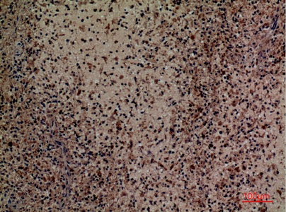 Fig.4. Immunohistochemical analysis of paraffin-embedded human-spleen, antibody was diluted at 1:100.