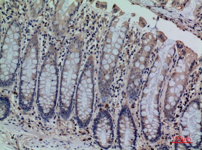 Fig.2. Immunohistochemical analysis of paraffin-embedded human-colon, antibody was diluted at 1:100.