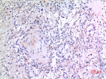 Fig.4. Immunohistochemical analysis of paraffin-embedded human-brain, antibody was diluted at 1:100.