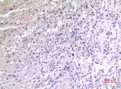 Fig.5. Immunohistochemical analysis of paraffin-embedded human-brain, antibody was diluted at 1:100.