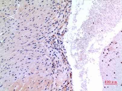 Fig.2. Immunohistochemical analysis of paraffin-embedded Mouse-heart, antibody was diluted at 1:100.