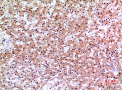 Fig.2. Immunohistochemical analysis of paraffin-embedded human-liver, antibody was diluted at 1:100.