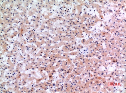 Fig.3. Immunohistochemical analysis of paraffin-embedded human-liver, antibody was diluted at 1:100.