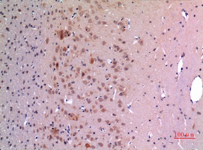 Fig.2. Immunohistochemical analysis of paraffin-embedded rat-brain, antibody was diluted at 1:100.