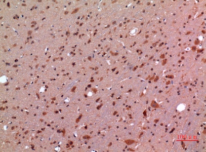 Fig.3. Immunohistochemical analysis of paraffin-embedded rat-brain, antibody was diluted at 1:100.