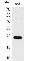 Fig. Western Blot analysis of Jurkat cells using IFN-ε Polyclonal Antibody. Secondary antibody (catalog#: A21020) was diluted at 1:20000.