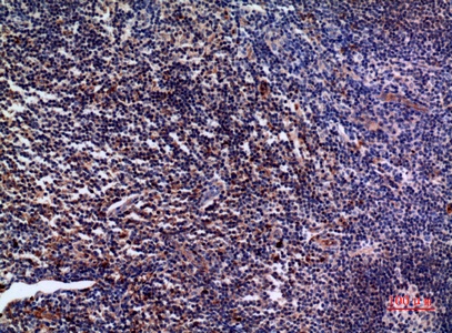 Fig.2. Immunohistochemical analysis of paraffin-embedded human-tonsil, antibody was diluted at 1:100.