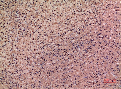 Fig.5. Immunohistochemical analysis of paraffin-embedded human-spleen, antibody was diluted at 1:100.