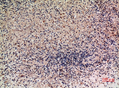 Fig.2. Immunohistochemical analysis of paraffin-embedded human-liver, antibody was diluted at 1:100.