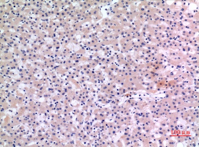 Fig.3. Immunohistochemical analysis of paraffin-embedded human-liver, antibody was diluted at 1:100.