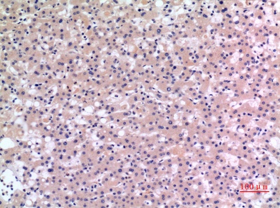 Fig.4. Immunohistochemical analysis of paraffin-embedded human-liver, antibody was diluted at 1:100.