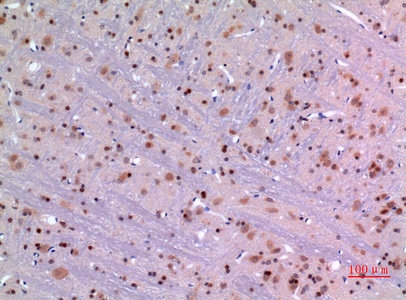 Fig.2. Immunohistochemical analysis of paraffin-embedded rat-brain, antibody was diluted at 1:100.