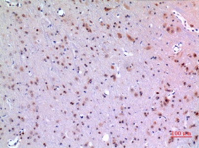 Fig.3. Immunohistochemical analysis of paraffin-embedded rat-brain, antibody was diluted at 1:100.
